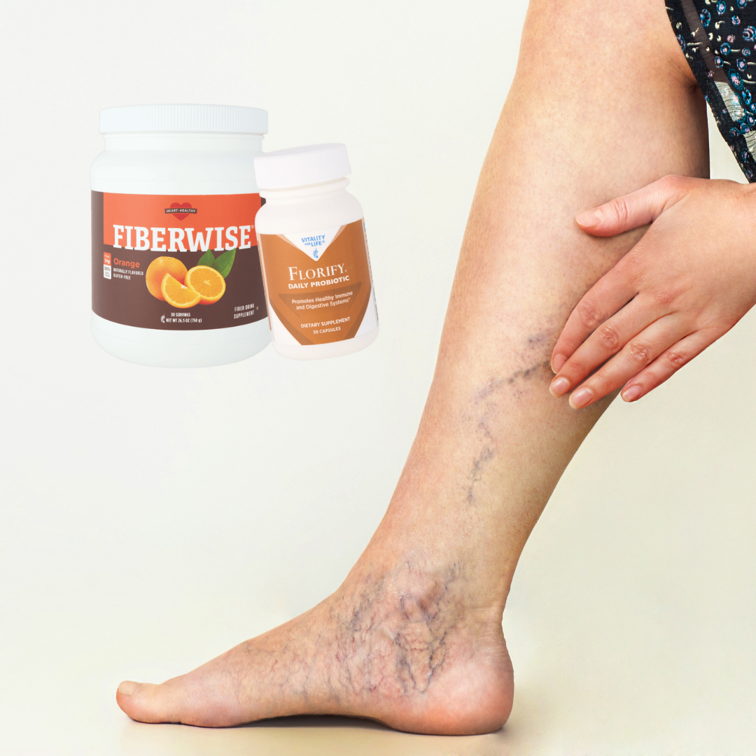Supporting Varicose Veins Naturally