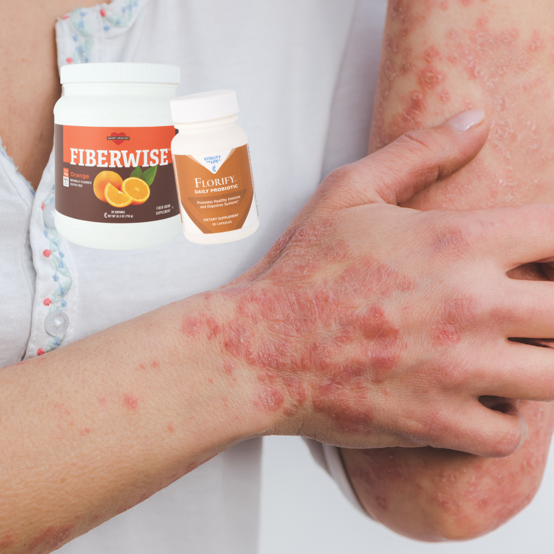 Autoimmune Health & Natural Solutions
